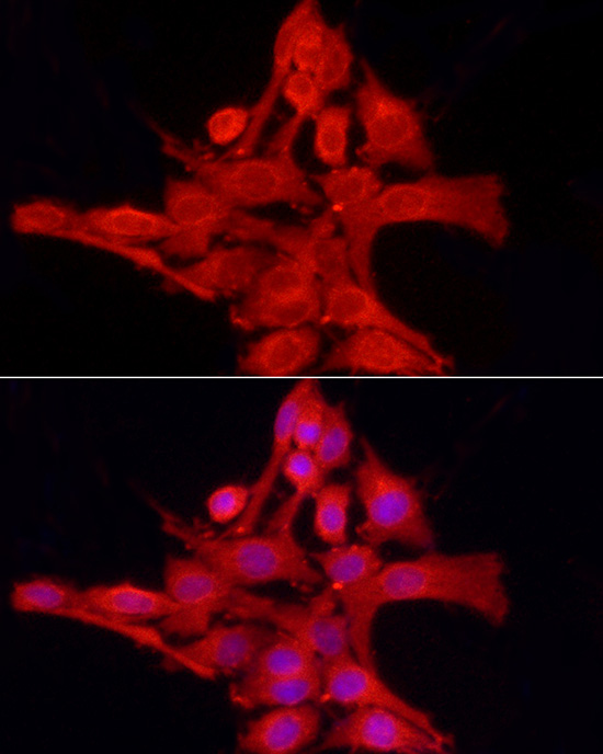 PTPN2 Rabbit polyclonal antibody
