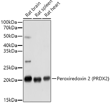 Peroxiredoxin 2 (PRDX2) Rabbit polyclonal antibody