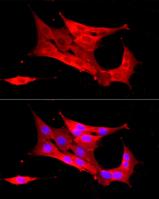 Peroxiredoxin 2 (PRDX2) Rabbit polyclonal antibody