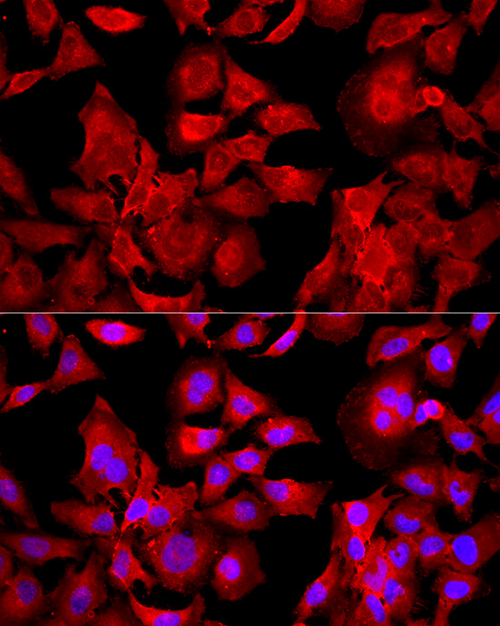 Peroxiredoxin 2 (PRDX2) Rabbit polyclonal antibody