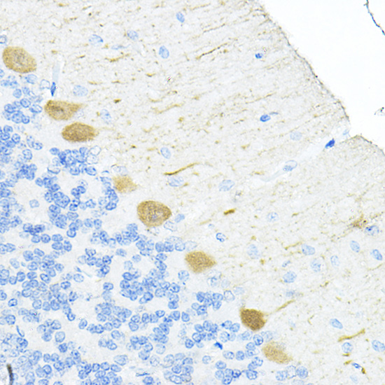 S100A6 Rabbit polyclonal antibody