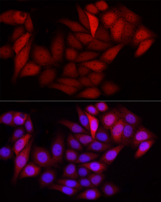 S100A6 Rabbit polyclonal antibody