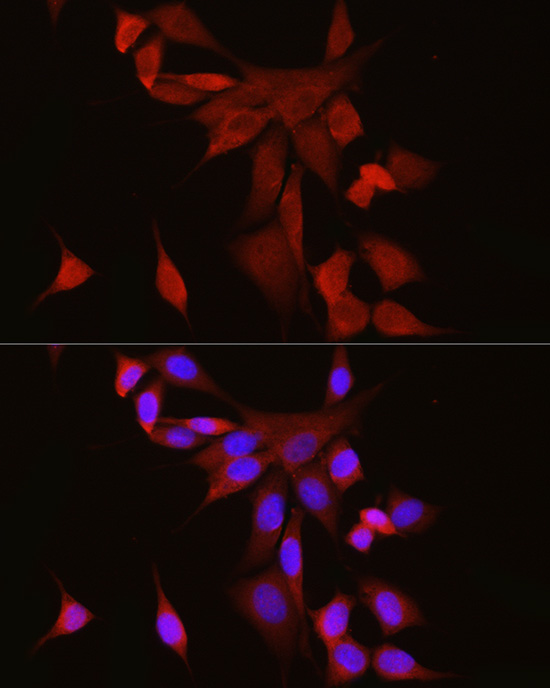 S100A6 Rabbit polyclonal antibody