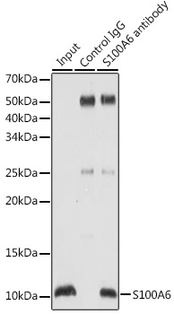 S100A6 Rabbit polyclonal antibody