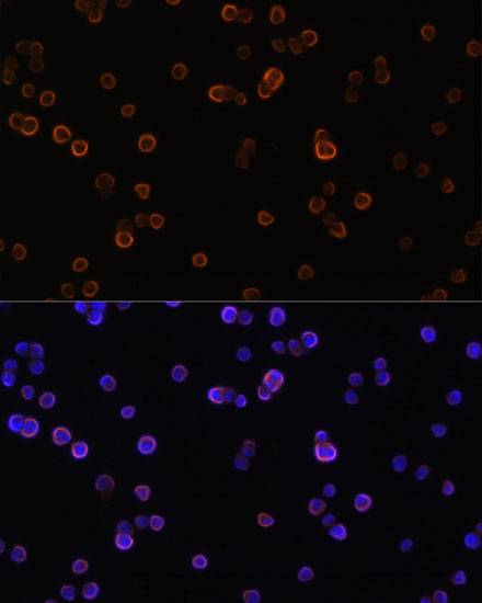 PLC gamma 2 (PLCG2) Rabbit polyclonal antibody
