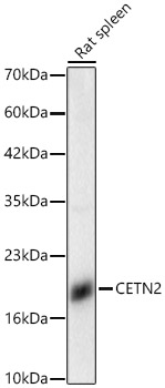 CETN2 Rabbit polyclonal antibody