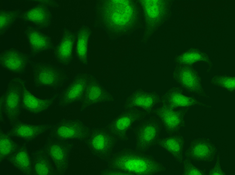 CETN2 Rabbit polyclonal antibody