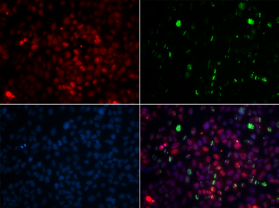 CETN2 Rabbit polyclonal antibody