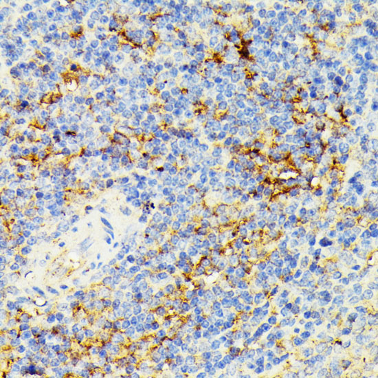 ECE1 Rabbit polyclonal antibody