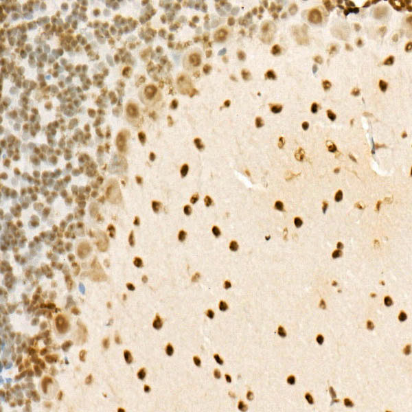 FUS Rabbit polyclonal antibody