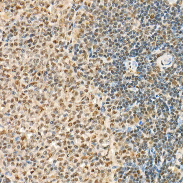 FUS Rabbit polyclonal antibody
