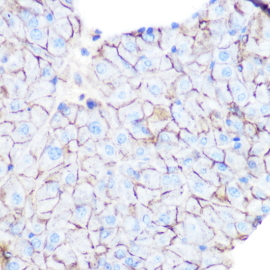Flotillin 1 Rabbit polyclonal antibody