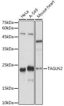 TAGLN2 Rabbit polyclonal antibody