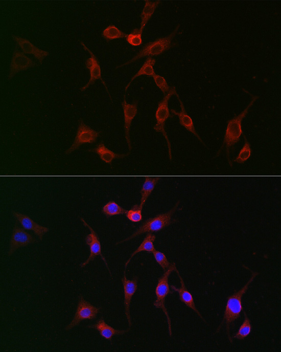 TAGLN2 Rabbit polyclonal antibody