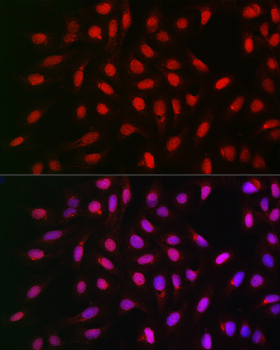 PPP1CA Rabbit polyclonal antibody