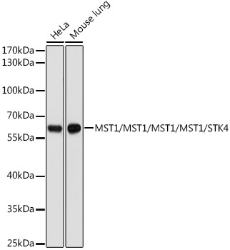 MST1 Rabbit polyclonal antibody