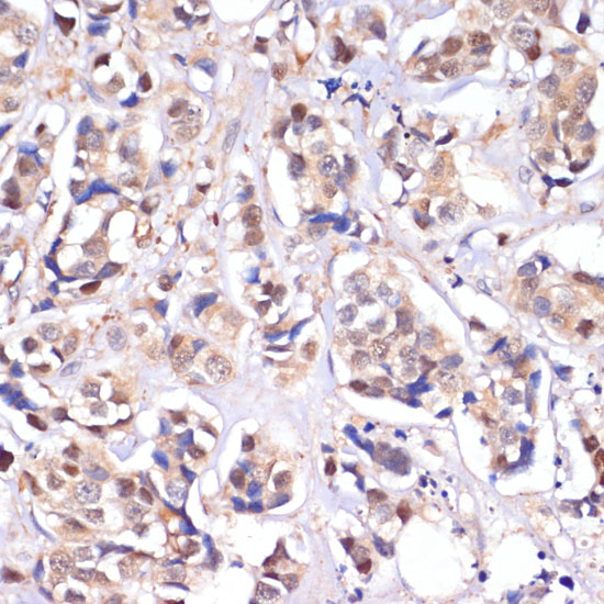 MST1 Rabbit polyclonal antibody