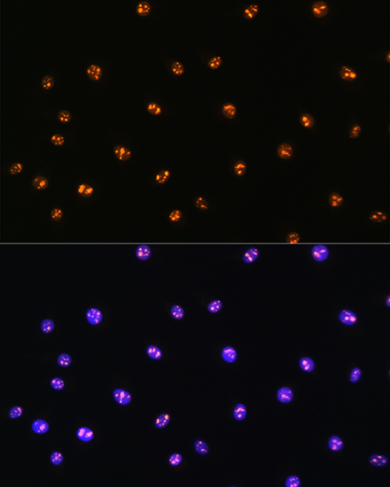 MST1 Rabbit polyclonal antibody