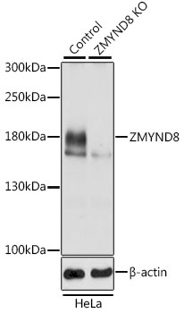 [KO Validated] ZMYND8 Rabbit polyclonal antibody
