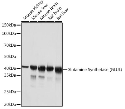 Glutamine Synthetase (GLUL) Rabbit monoclonal antibody