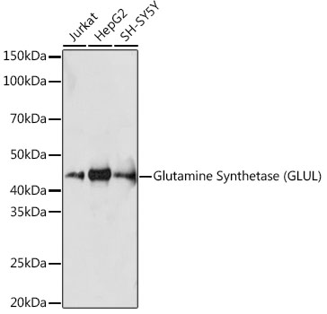Glutamine Synthetase (GLUL) Rabbit monoclonal antibody