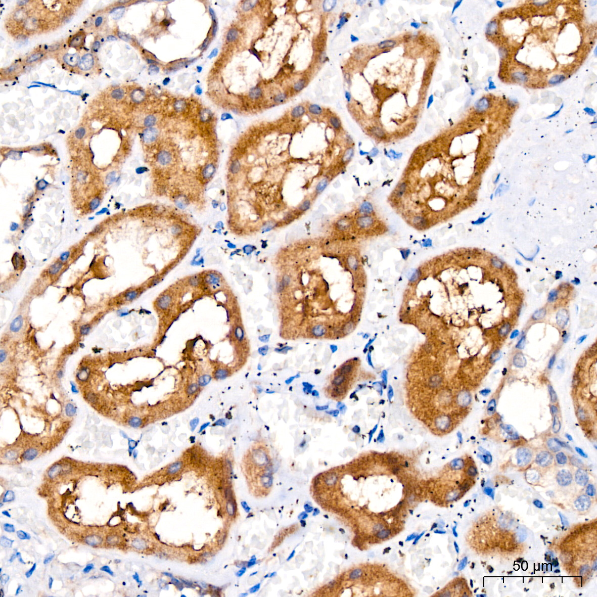 Glutamine Synthetase (GLUL) Rabbit monoclonal antibody