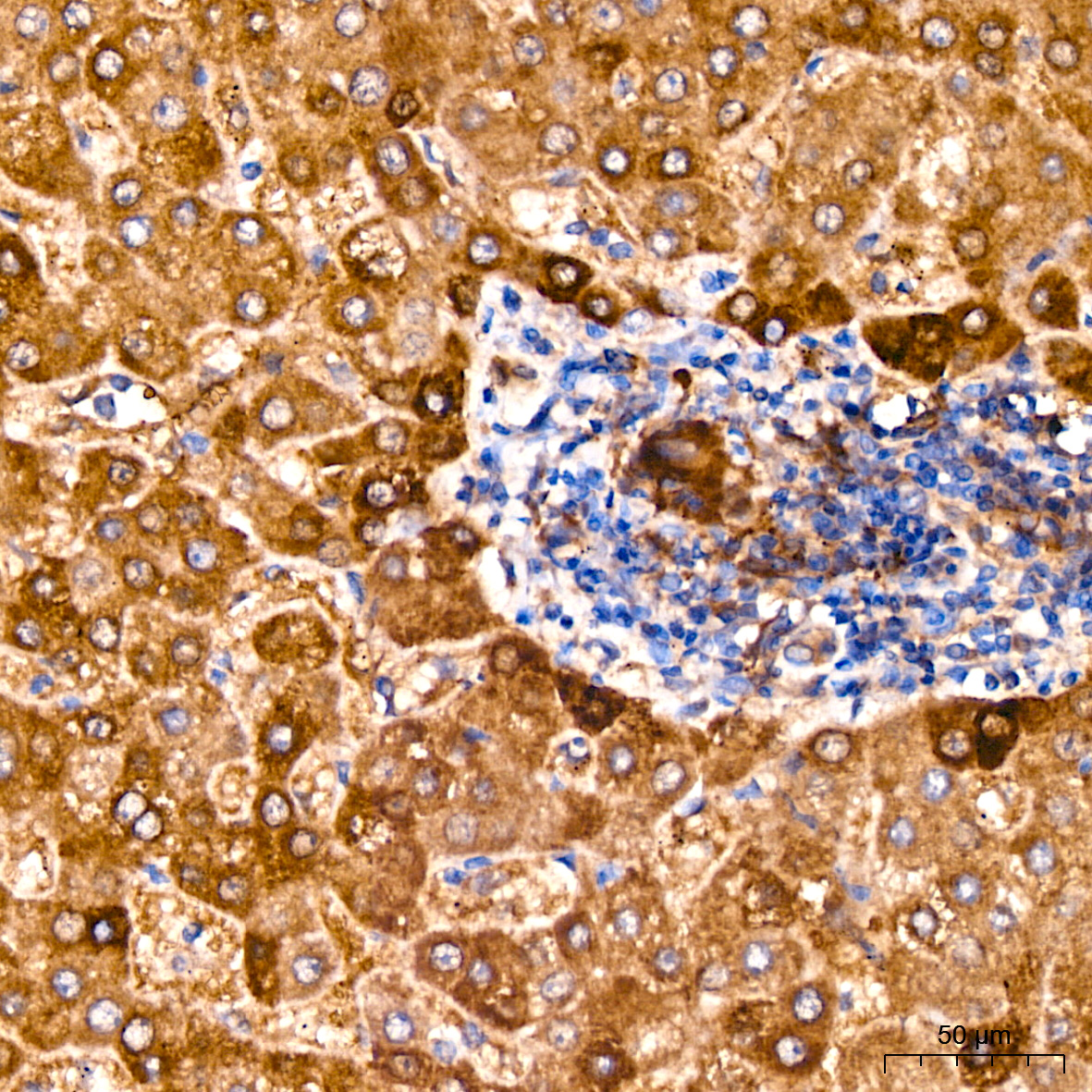 Glutamine Synthetase (GLUL) Rabbit monoclonal antibody
