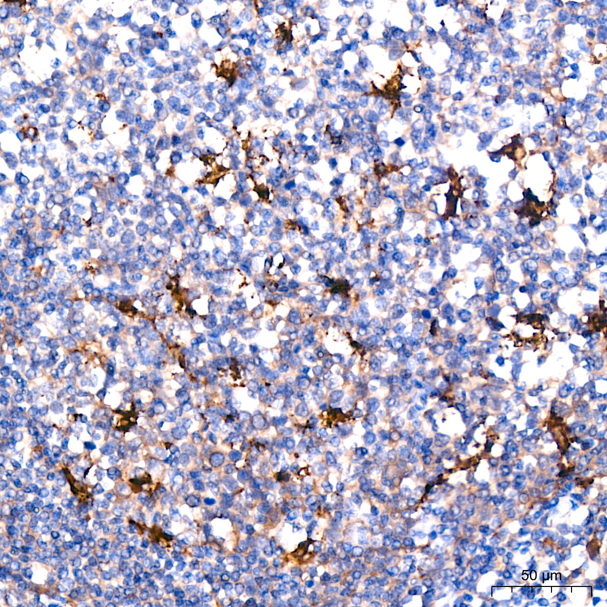 Glutamine Synthetase (GLUL) Rabbit monoclonal antibody