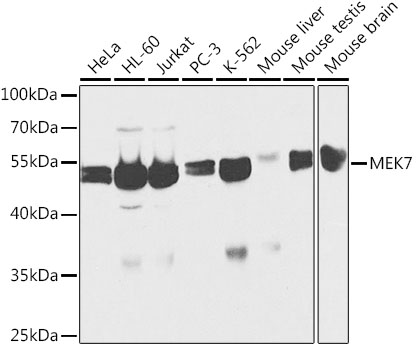 [KO Validated] MEK7 Rabbit polyclonal antibody
