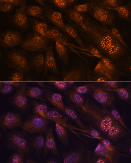[KO Validated] MEK7 Rabbit polyclonal antibody