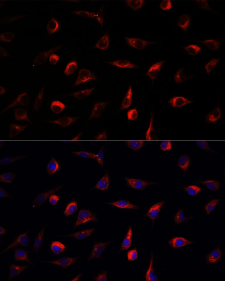 [KO Validated] MEK7 Rabbit polyclonal antibody