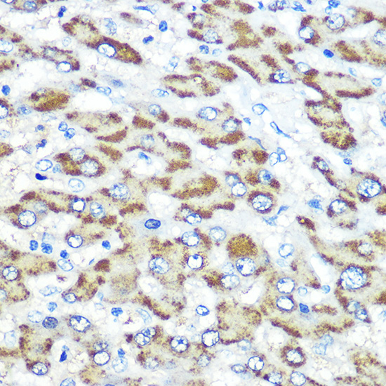 Presenilin 1 Rabbit polyclonal antibody