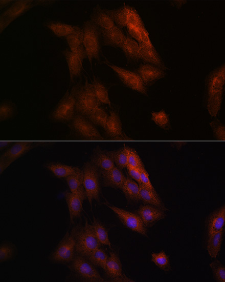 Presenilin 1 Rabbit polyclonal antibody