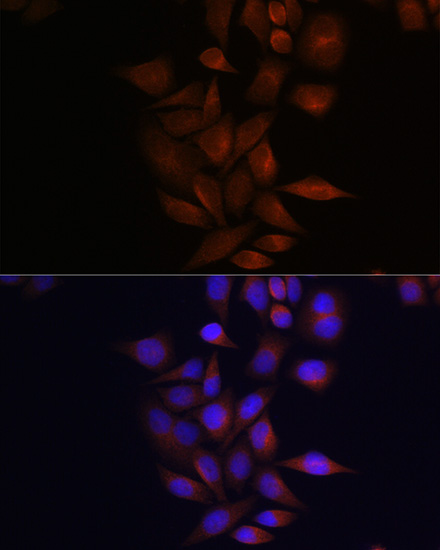 Presenilin 1 Rabbit polyclonal antibody