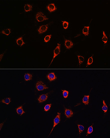 Presenilin 1 Rabbit polyclonal antibody