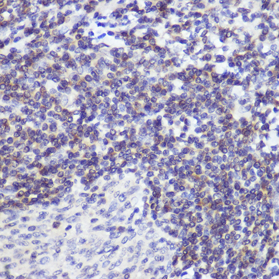 Western blot analysis of lysates from wild type (WT) and Bcl-2 knockdown (KD) 293T cells using [KD Validated] Bcl-2 Rabbit mAb (A21873) at 1:1000 dilution incubated overnight at 4℃.<br/>Secondary antibody: HRP-conjugated Goat anti-Rabbit IgG (H+L) (AS014) at 1:10000 dilution. <br/>Lysates/proteins: 25 μg per lane.<br/>Blocking buffer: 3% nonfat dry milk in TBST.<br/>Detection: ECL Basic Kit (RM00020)<br/>Exposure time: 30s.