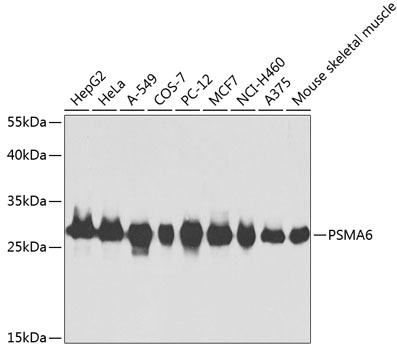 PSMA6 Rabbit polyclonal antibody