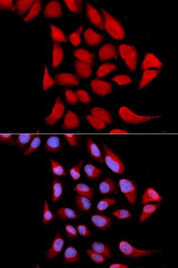 PSMA6 Rabbit polyclonal antibody