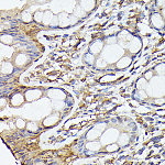 Immunohistochemistry - NF-kB p65/RelA Rabbit mAb (A21898)