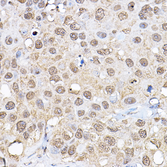 p70 S6 Kinase 1 Rabbit polyclonal antibody
