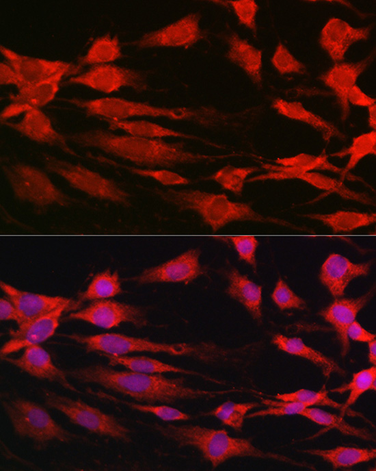 p70 S6 Kinase 1 Rabbit polyclonal antibody