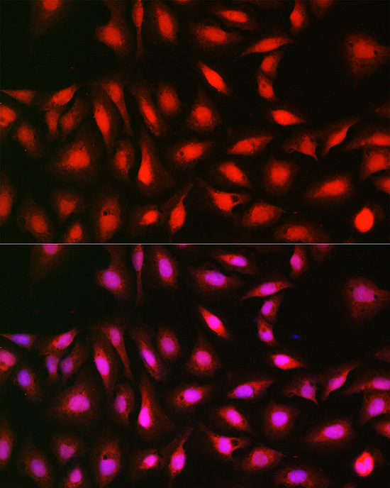 p70 S6 Kinase 1 Rabbit polyclonal antibody
