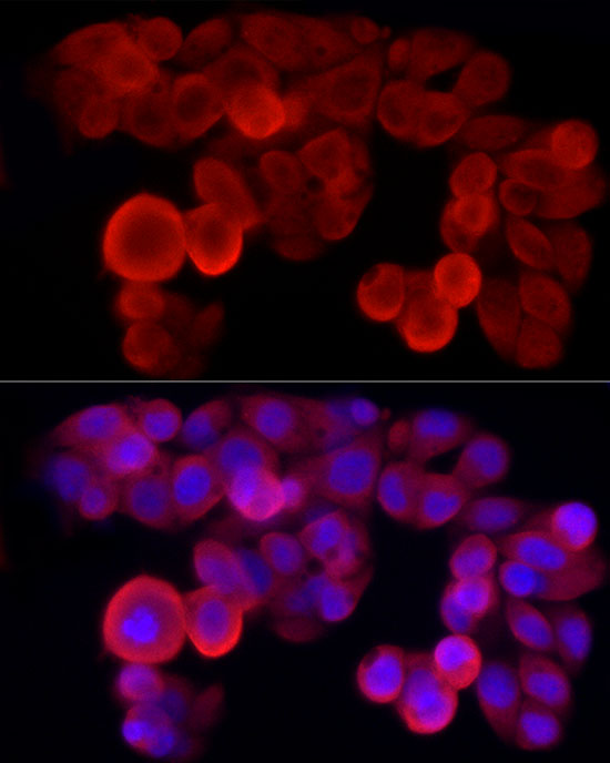 NLRP3 Rabbit polyclonal antibody