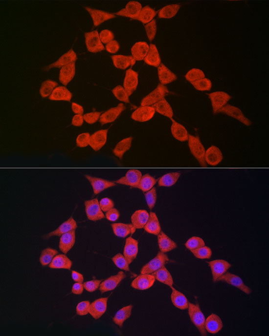 NLRP3 Rabbit polyclonal antibody