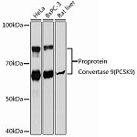 Western blot - Proprotein Convertase 9(PCSK9) Rabbit mAb (A21909)