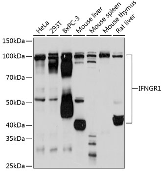 IFNGR1 Rabbit monoclonal antibody