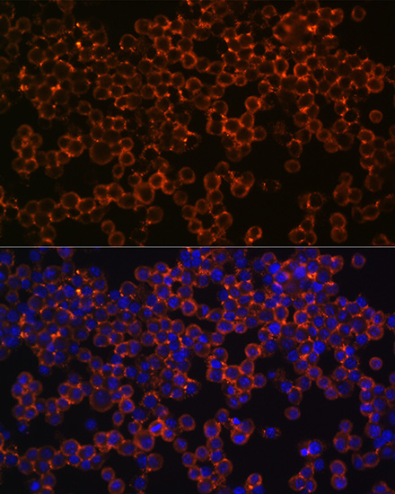 IFNGR1 Rabbit monoclonal antibody