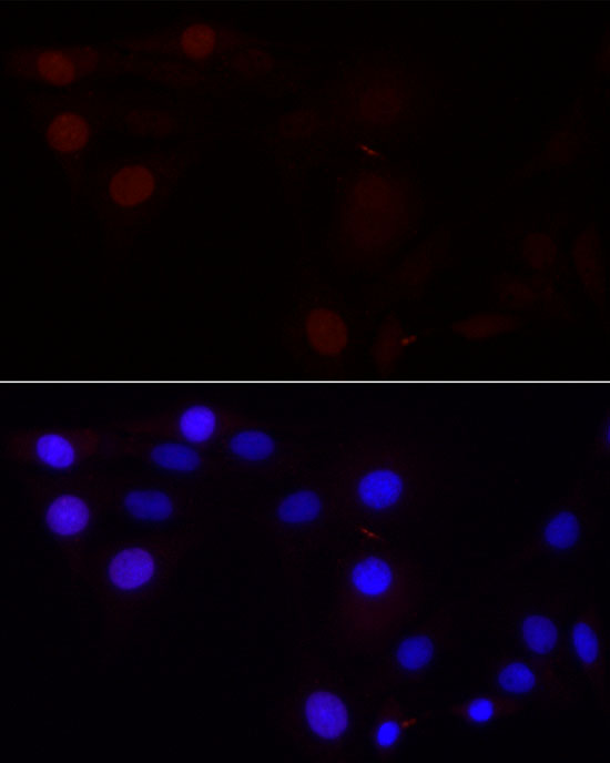 [KD Validated] Aurora B Rabbit monoclonal antibody