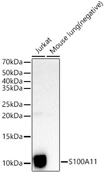 S100A11 Rabbit polyclonal antibody
