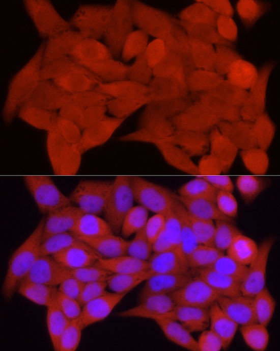 S100A11 Rabbit polyclonal antibody
